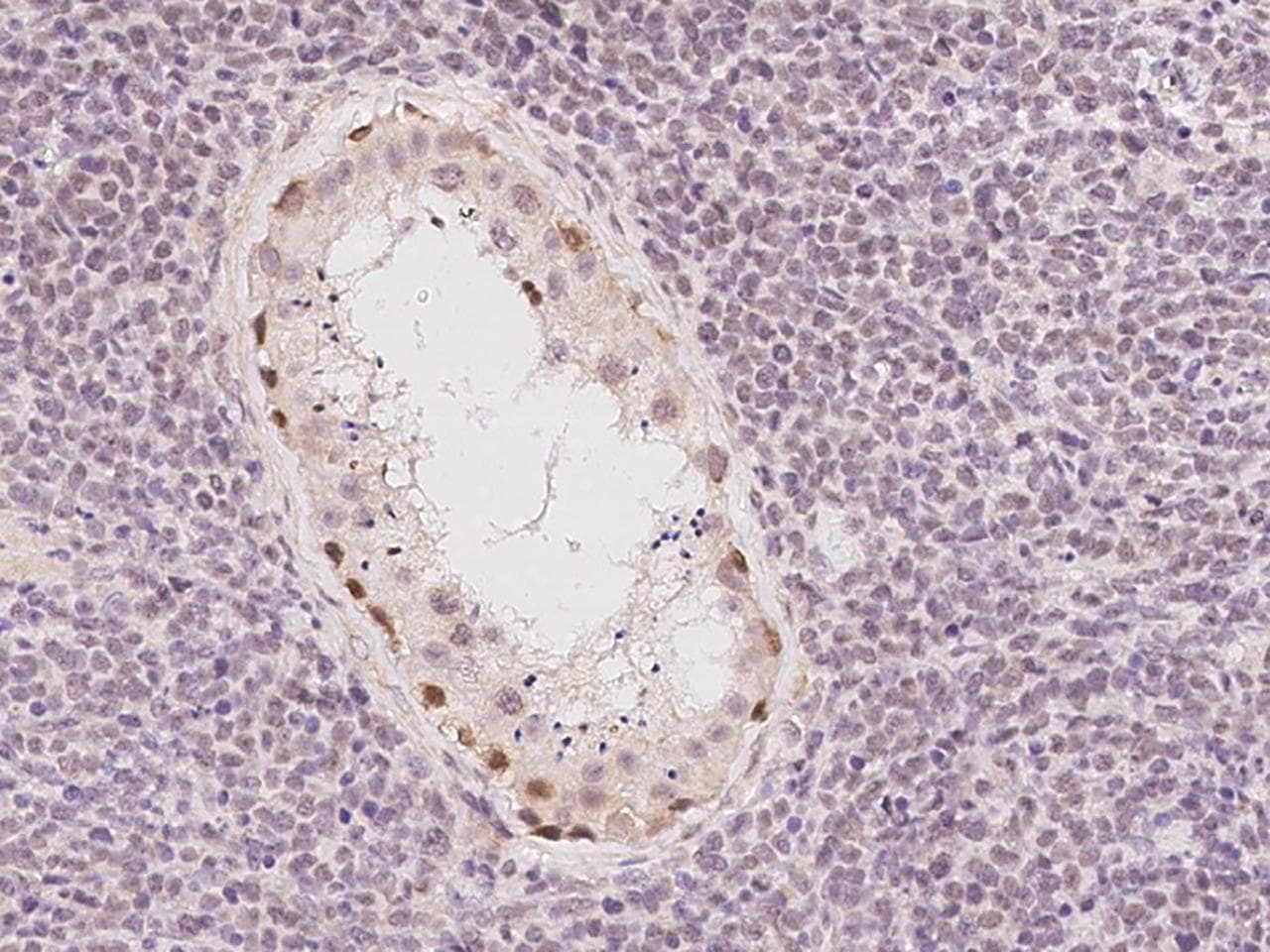 NR1H2 / LXR Beta Antibody