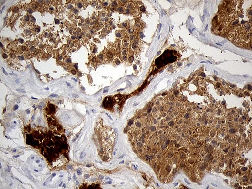 Monoclonal Mouse anti-Human KLC2 Antibody (clone OTI10H10, aa335-622, IHC, WB)