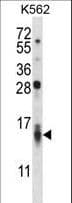 CCL15 / MIP5 Antibody (aa71-100)