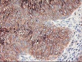 RPN1 / Ribophorin I Antibody (clone OTI6A9)
