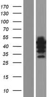 WIPI2 Protein (Over-Expression Lysate Myc-DDK (Flag))