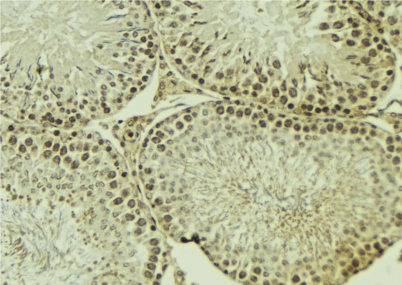 PRKCZ / PKC-Zeta Antibody