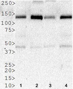 Polyclonal Rabbit anti-Human HDAC5 Antibody (aa1-100, IHC, IF, WB)