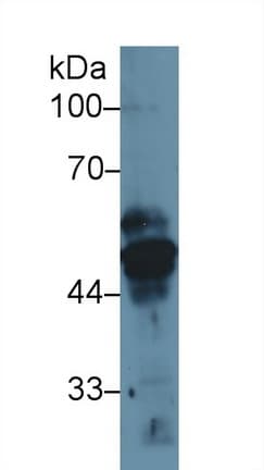 KRT17 / CK17 / Cytokeratin 17 Antibody (aa84-392)