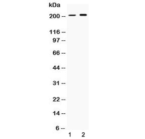 PPL / Periplakin Antibody