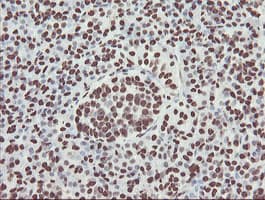 NONO / P54NRB Antibody (clone OTI2C9)