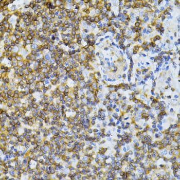 MT-ND5 Antibody