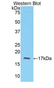 Preprovasopressin Antibody (aa24-168)