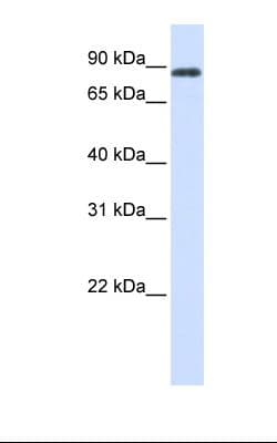 Polyclonal Rabbit anti-Human HECTD2 Antibody (aa684-733, IHC, WB)