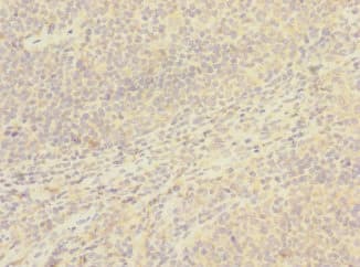 CD8B / CD8 Beta Antibody