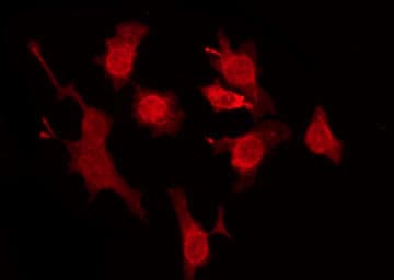 FAM84B Antibody