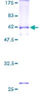 Human SETD4 Protein (Recombinant GST)