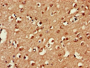 Polyclonal Rabbit anti-Human UBP43 / USP18 Antibody (IHC, IF, WB)