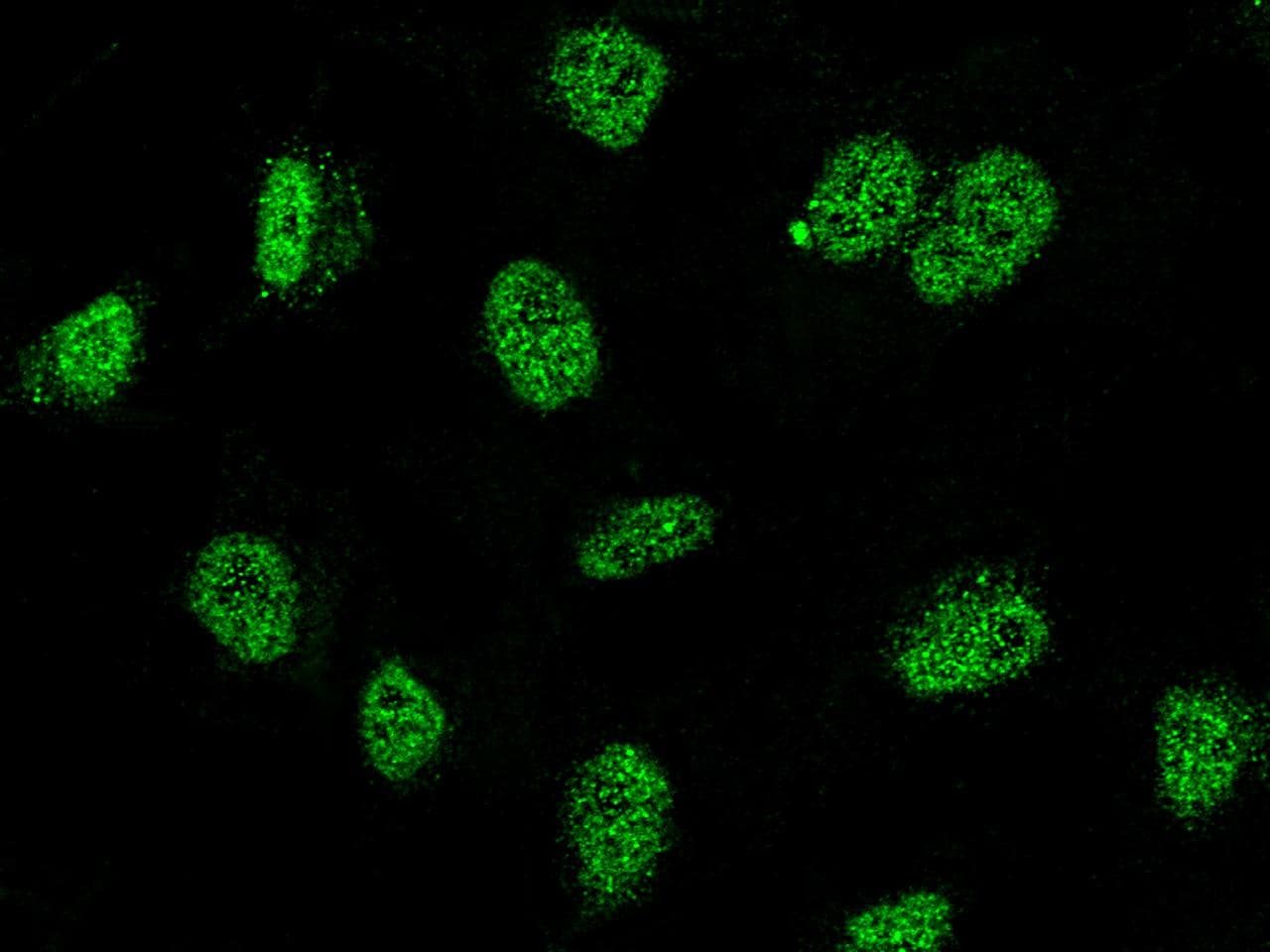 RING1 Antibody (Preservative Free)