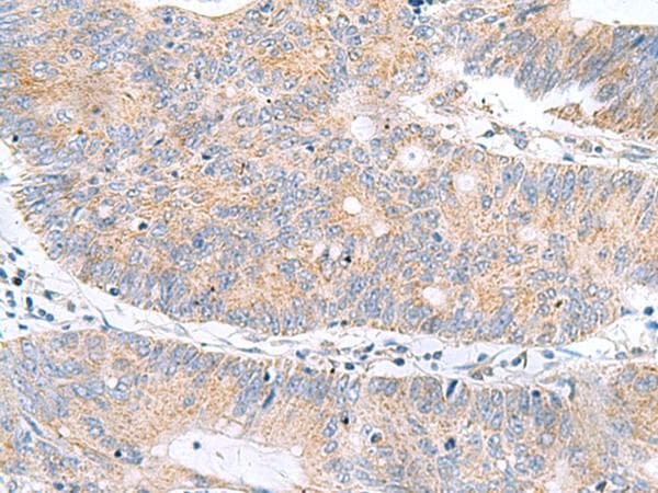 Polyclonal Rabbit anti-Human HRSP12 / UK114 Antibody (IHC, WB)