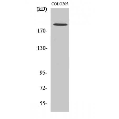 TUBGCP6 / GCP6 Antibody (710-790 aa, Internal)