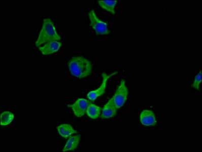 Polyclonal Rabbit anti-Human HSorCS / SORCS1 Antibody (IHC, WB)