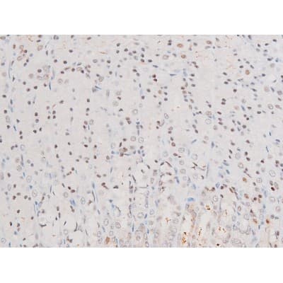 RELA / NFKB p65 Antibody (phospho-Ser281)