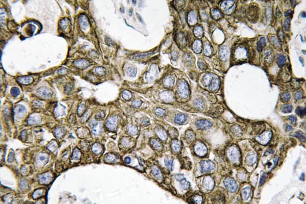 KRT19 / CK19 / Cytokeratin 19 Antibody (Leu349)