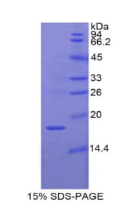 Pig RBP2 / CRBPII Protein (Recombinant His)