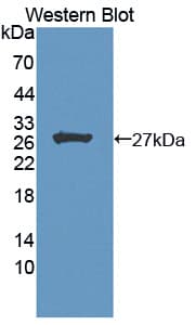 MEN1 / Menin Antibody (aa219-395, Biotin)