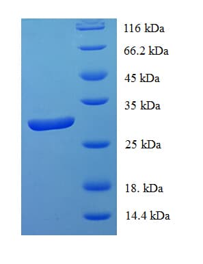 Human ID / ID1 Protein (Recombinant His-SUMO)