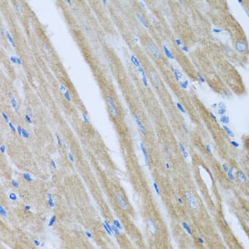 CCM2 / Malcavernin Antibody