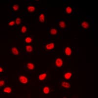 CREB1 / CREB Antibody (Internal)