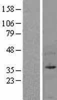 UFD1L Protein (Over-Expression Lysate Myc-DDK (Flag))
