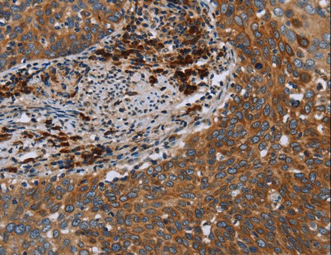 HYAL3 Antibody