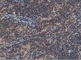 ACAT2 Antibody (clone OTI7B1)