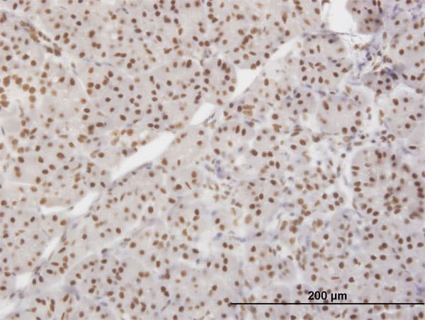 XRCC5 / Ku80 Antibody (clone 3D8)