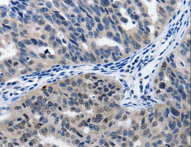 Polyclonal Rabbit anti-Human MATN1 / Matrilin 1 Antibody (IHC)