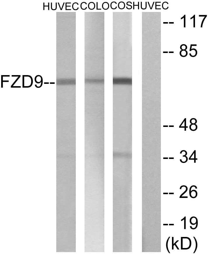 IHC-plus™ Polyclonal Rabbit anti-Human FZD9 / Frizzled 9 Antibody (aa542-591, IHC, IF, WB)