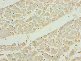 EPM2AIP1 Antibody