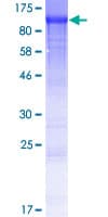 Human WDR62 Protein (Recombinant GST)