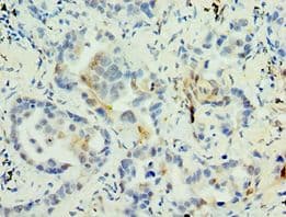 MAGEA6 Antibody (aa75-314)