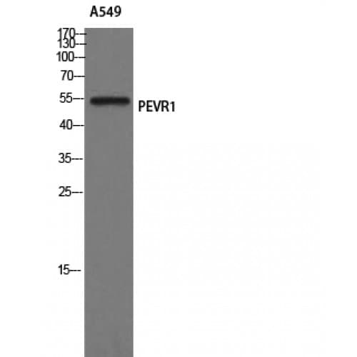 SLC52A2 / GPR172A / PAR1 Antibody (20-100 aa, Internal)