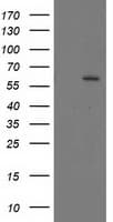 CYP17 / CYP17A1 Antibody (clone OTI5G10)