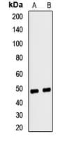 FECH / Ferrochelatase Antibody