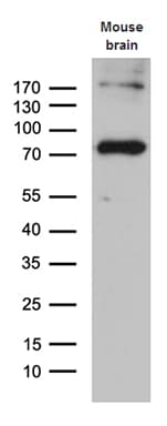 ACS5 / ACSL5 Antibody (aa104-620, clone OTI1C6)