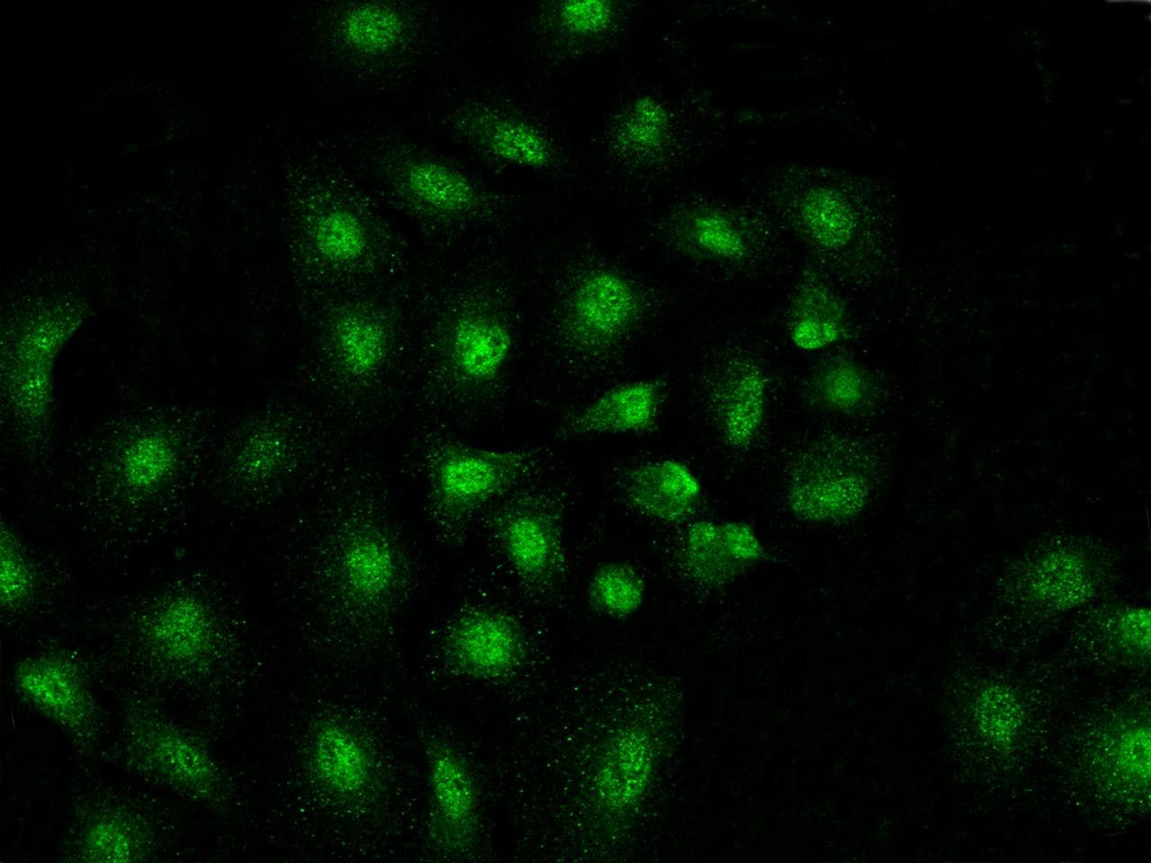 Polyclonal Rabbit anti-Human MAD2L1 / MAD2 Antibody (IHC, IF, WB)
