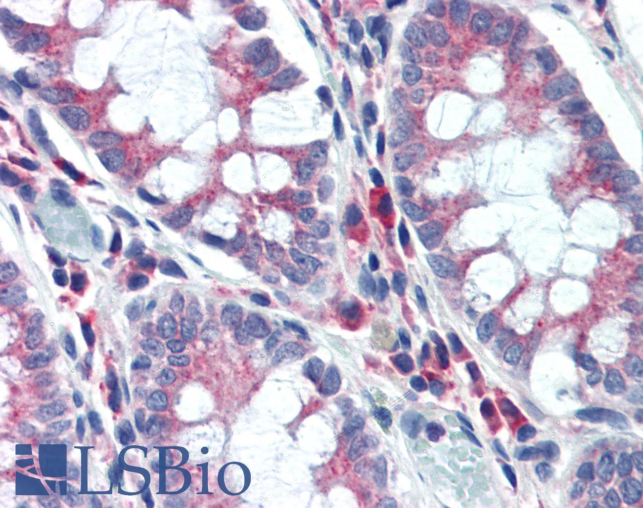 IHC-plus™ NPC / NPC1 Antibody (clone 17B5)