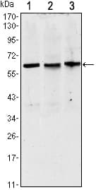 PAX8 Antibody (clone 2D4)