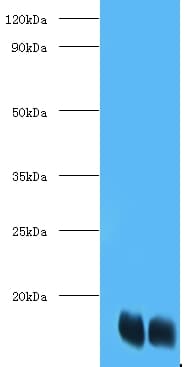 FABP1 / L-FABP Antibody (Biotin)