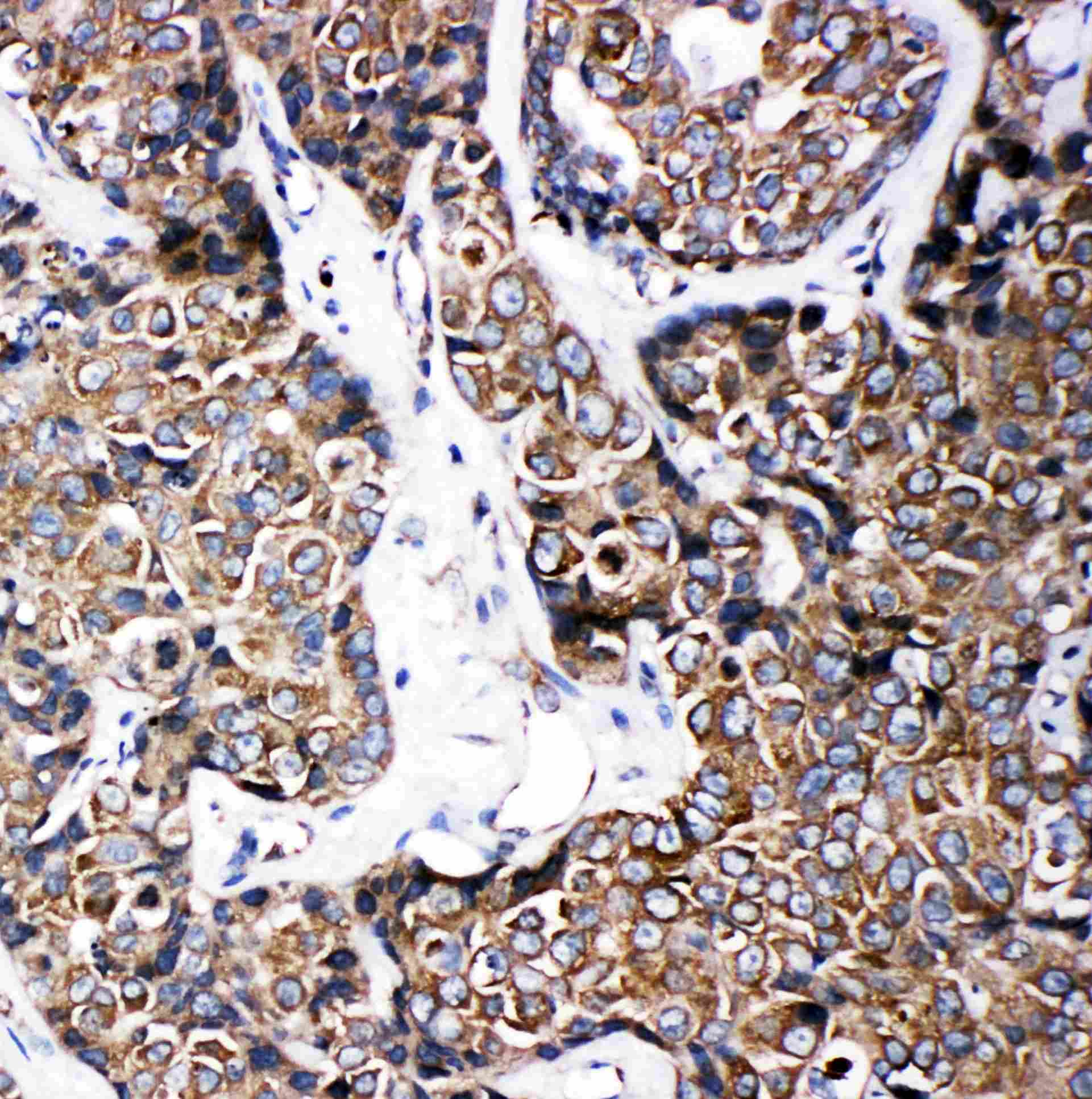 Polyclonal Rabbit anti-Human ABCB6 Antibody (aa818-842, IHC, WB)