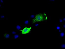 IHC-plus™ MCL1 / MCL 1 Antibody (clone 10C5)