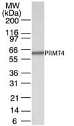 PRMT4 / CARM1 Antibody (aa45-69)