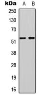 TP53 / p53 Antibody (C-Terminus)