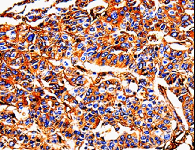 ALB / Serum Albumin Antibody